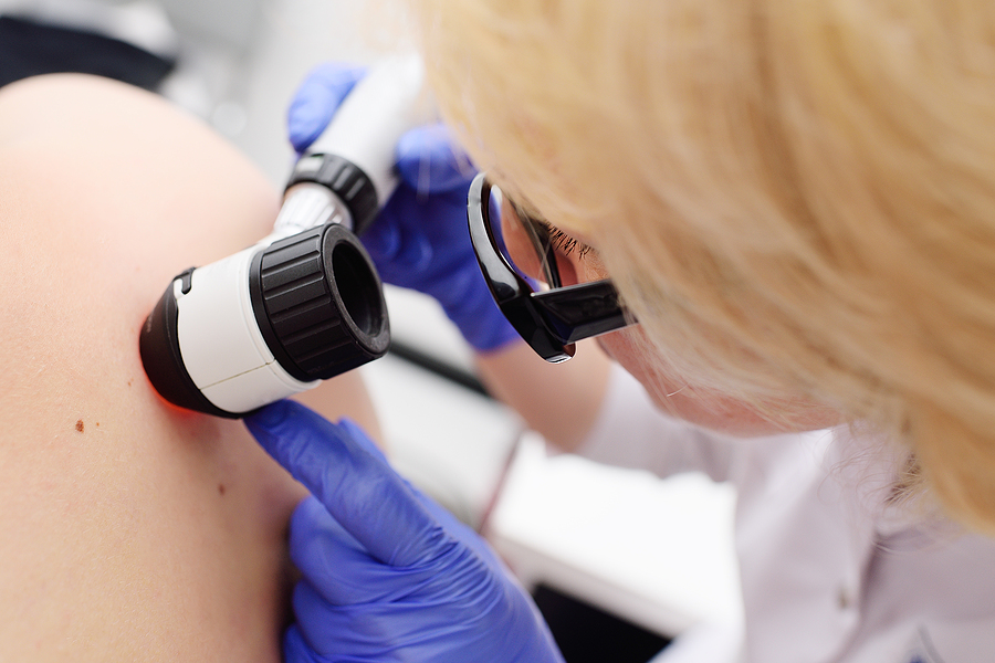 Skin checks in Colac