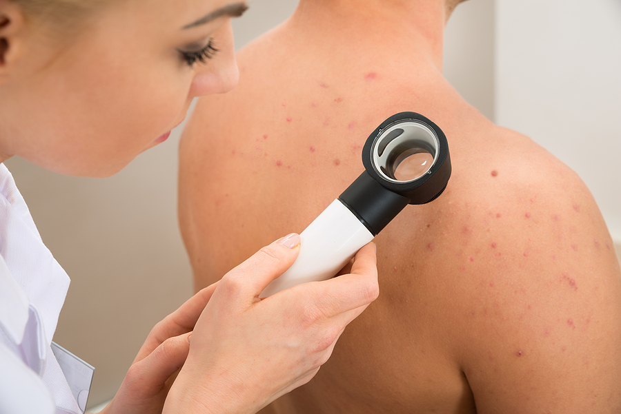 Skin checks in Geelong pick up early signs of cancer